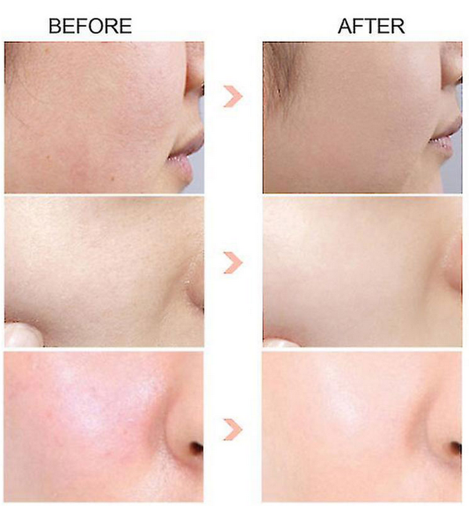 سرم پیلینگ اوردینری  Aha,bha